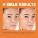 L'Oreal Paris Revitalift 12% Pure Vitamin C Serum, Brightening Serum For Face with Vitamin E, Salicylic Acid, 1 oz + Moisturizer Sample