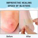 50 PCS Gel Blister Bandages for Feet, Toe Cushions Prevention Pads Bandaid, Blaster Protection Bandaids, Recovery Variety Pack