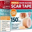Medical Grade Silicone Scar Tape - 1.6x150 - Visible Difference on Keloid & -Section - Reusable Silicone Scar Sheets - Easy to Use (Beige)