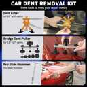 Super PDR Paintless Dent Repair Kit 148PCS Dent Puller Kit with LED Light Board Can Removal 99% of Car Dents in 30 Minutes for Repair Work of Big Dents, Small Dents, Door Ding, Creases and Hail Damage (EXP 12/31/36)