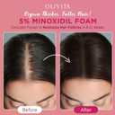 5% Minoxidil Foam for Women Hair Growth: Extra Strength Hair Regrowth Treatment Revitalize Hair Follicles & Regrow Thicker, Fuller Hair Hair Loss Solution 2pcs