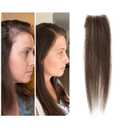 scar human hair replacement Accidental burns without hair for men women Hairline Loss Straight Tape in Replacement Toupee (Dark Brown, 0.78"x1.5")