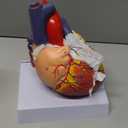 2X Enlarged Anatomical Heart Model - Human Heart Model with Rigth/Left Atrial Appendage Anatomical Model for Science Classroom and Cardiology Study
