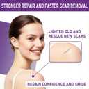 Scarlette Collagen Tape, Scarlette Collagen Sheets for Scars & Wrinkle, Silicone Scar Removal Strips for Various Different Scars and Wrinkles,ReusableC-Section, Burn, Acne, Surgical Scars (1pcs)