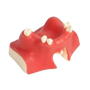 Dental Implant Training Model with Maxillary Sinus Lift Practice Realistic Simulation Jaw Cavity Lift Implant Placement Model