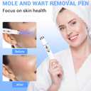 Maximum Strength WART Remover,Mole and Wart Removal Pen,Dark Spot Remover for Face and Body, Comfortable and Effevtive.