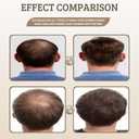 3 x Root Activator Hair Loss Thickening Shampoo for Hair Regrowth, Unisex, Natural Formula for Men and Women1 PCS