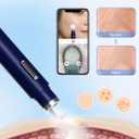 Visual Blackhead Remover Tools with Camera,Pimple Popper Extractor Tool Kit with Camera 20X 1080P Pore Cleaner Acne Comedone Whitehead Extractor Kit for iPhone/Android (Blue)