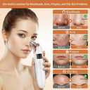 2026 Pore Vacuum, Rechargeable Blackhead Remover Vacuum with 5 Suction Heads, Face Vacuum Pore Cleanse 3 Adjustable Suction Levels, Stainless Steel Tools for Nose Face, At-Home Skincare Kit- White