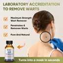 2 x "STAY STOKED" Wart Remover, Maximum Strength Wart Remover Freeze Off - Heavy-Duty Treatment for Stubborn Plantar Warts, Corns & Common Warts, Fast Results in 1-2 Weeks-H5516