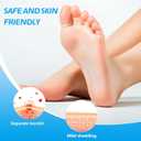 HEALMUSZ Fast-Acting Wart Remover Cream,Salicylic Acid Warts Removal Cream for Men Women, Wart Freeze Off for Feet Hands for Plantar, Flat, Common, Corn, H Warts, Callus 20g