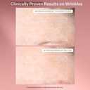StriVectin SD Advanced Plus Intensive Moisturizer for Wrinkles and Stretchmarks, For Face and Body, Collagen Boosting with Peptides and Hyaluronic Acid (4 Ounce (Pack of 1))