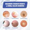 2 x Likluc Fast-Acting Wart Remover Gel with Freeze Off Technology - Genital, Common Warts & Plantar wart Remover for Feet, Skin & More