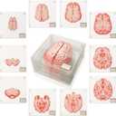 ThinkGeek Anatomic Brain Specimen Coasters Set of 10 for Neuroscience Medical Student Gifts Human Anatomy Generix Geek