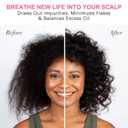 Stimulating Scalp and Hair Balm, Nourishes Scalp & Hair, Shea Butter and Mango Butter Blend (1Pcs)