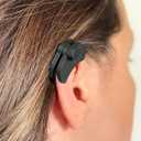 Keloid Compression Earring Clinically Designed Medical Pressure Helix Earlobe for Ear Keloid Removal, Post-Surgery Healing & Scar Wound Treatment