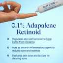 Differin Acne Treatment Gel, 30 Day Supply, Retinoid Treatment for Face with 0.1% Adapalene, Gentle Skin Care for Acne Prone Sensitive Skin, 15g Tube 