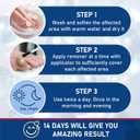 SKAYAH Wart Remover Freeze Off - Professional Strength Wart Remover Liquid - 5% Salicylic Acid Fast-Acting Treatment for Plantar Wart,Flat Wart, Corn and Callus Remover, 15ml (0.5 fl oz)-H236