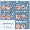 JPNK Blackhead Remover Tool Comedones Extractor Acne Removal Kit for Blemish, Whitehead Popping, 6 Pcs Zit Removing for Nose Face Tools with a Leather Bag (Silver)