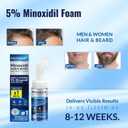 5% Minoxidil Foam, Minoxidil for Men Foam, Minoxidil for Women Hair Growth, Minoxidil for Men and Women. (2 Ounce)