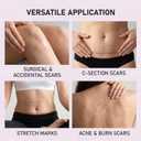Scarlette Collagen Tape, Scarlette Collagen Sheets for Scars & Wrinkle, Silicone Scar Removal Strips for Various Different Scars and Wrinkles(C-Section, Burn, Acne, Surgical Scars) (1pcs)