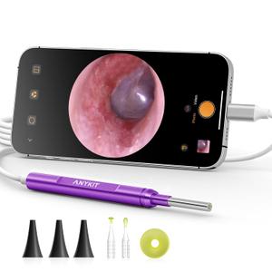 Anykit USB-C Digital Otoscope for Type-C Phone & Tablet, Ultra Clear View Ear Camera with Ear Wax Removal Tools, Video Ear Scope Otoscope with Light, Support Capture Photo & Record Videos (Purple)