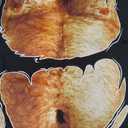 Bachleor Party Fake Hairy Chest for The Best Bachelor Party T-Shirt, 5XLT