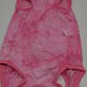 SlowTon Dog Recovery Suit - Surgery Recovery Suit for Female Male Dogs, Dog Onesie After Spay Abdominal Wounds, E-Collar Cone Alternative Prevent Licking Pet Surgical Suit (Pink,XXL) 