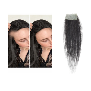 human hair bald spot hair patch toupee scar human hair replacement hairline loss straight Tape for men and women (Natural Black, 0.78"*1.57")