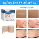 Silicone Scar Sheets, Silicone Scar Tape Roll (60x1.6), Professional Scars Removal Treatment, Scar Silicone Strips, Reusable Silicone Scar Strips Type for Keloid, C-Section, Surgery, Keloid, Acne