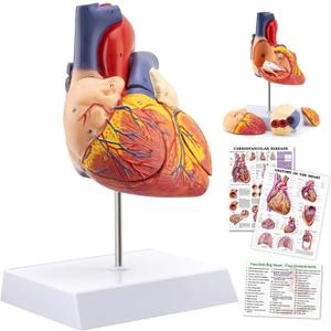 TYRRDE 2X Life Size Anatomical Heart Model  Human Heart Model Anatomy with 49 Structures, 4 Detachable Parts, Strong Magnetic Assembly, Accurate Details, on Base  for Medical Teaching & Science Learning(dark red) (yellow)