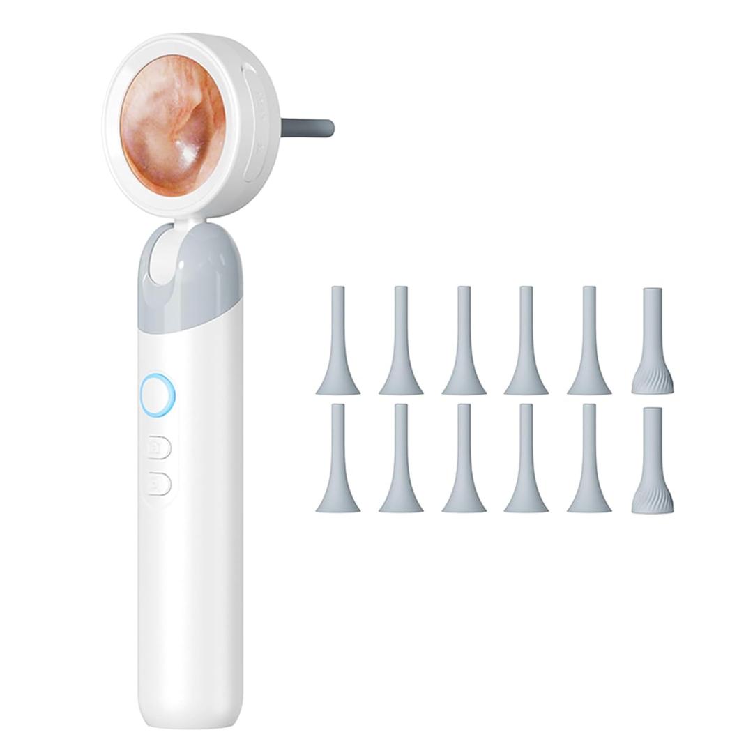Ear Camera with 1.21 Screen, 1080P HD Digital Otoscope Ear Scope with 4 LED Lights, Skin Inspection Probe, 10 Ear & Nose Tips, 6 Ear Pick Tools, for Adults Kids Pets, Type-C Charging (White)