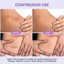 Antaly Silicone Scar Sheets, Silicone Scar Tape, Medical Grade Skin Patches for Surgical Scars, Keloid Bump Removal, C-Section, Stretch Marks, Hypertrophic, Post-Surgery-1.6"X 79" Roll, 2M