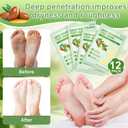 12Pack Moisturizing 8Pack Foot Peeling Foot Mask, Hydrating Foot Masks Dry Cracked Feet,Soothing Moisturizer Repair Rough Heels Baby Soft Feet,Exfoliator Peel Calluses Dead Skin Callus Remover(20p)