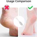 2 Pcs Stainless Steel Metal Foot File Double Sided Callus Remover Scraper Professional Pedicure Tool for Dead Skin Rough Heels Foot Care Exfoliating Instrument Durable Easy to Clean