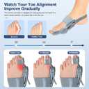 Bunion Corrector for Women & Men, Orthopedic Bunion Splint with Toe Separator, Adjustable Bunion Corrector for Bunion Relief, Suitable for Left and Right Feet (2)