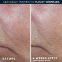 RoC Derm Correxion Retinol Firming Serum Stick with Antioxidants to Visibly Tighten and Firm Wrinkles and Laugh Lines 1.0 oz plus Retinol Eye Cream Packette