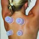 Silicone Cupping Therapy Set - Massage Therapy Cups for Arthritis, Pain Relief, Anti Aging, and Anti-Cellulite - Cupping Kit for Relaxation and Muscle Recovery