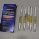 Nail Fungus Treatment Extra Strength: 25% Undecylenic Acid Formula - Toenail Fungus Treatment Kit with 5 Pens & Nail File for Ingrown Nails, Discoloration & Brittle Nails